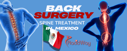 Back Surgery in Mexico - Spine Treatment Cost & Clinics